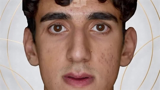 جراحی همزمان دو فک و چانه