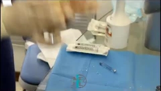 تزریق چربی با دستگاه پزشکی Nano Fat Kit