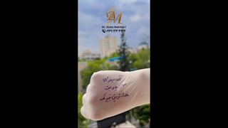 مراقبتهای بعد از تزریق فیلر