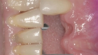 طراحی استوری اینستاگرام حرفه ای دندانپزشکی | خدمات تولید محتوا اینستاگرام بیاسا