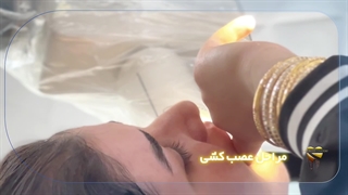 فیلم مراحل عصب کشی دندان در مطب دکتر قاسمی