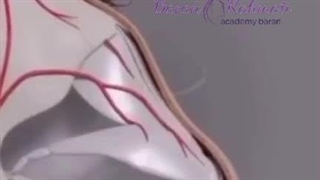 بهترین روش کوچک کردن بینی بدون عمل جراحی و بیهوشی فقط با 30 دقیقه