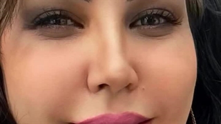 تزریق ژل لب در بوشهر