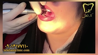 مراحلی از ارتو دنسی