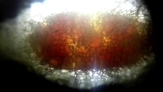 مشاهده حرکت لاروهای داخل کوکون |صنعت زالو ایران