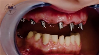 دکتر عباس گشاده رو دندانپزشک زیبایی