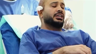 کاشت مو آقایان در نوین ایرانا مشهد؛ بهترین انتخاب برای یک تغییر بزرگ! 