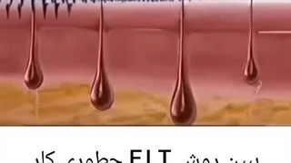روش F.I.T برای رشد مو – نحوه عملکرد و مزایا