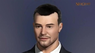 بهترین روش کاشت مو کدام است؟