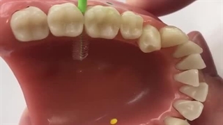 کاربرد مسواک بین دندانی