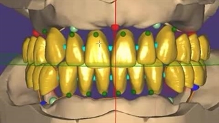 آنالیز دیجیتال لبخند؛ قدم اول برای لبخندی دقیق و متناسب