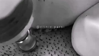 کلینیک پارسی کاشت مو