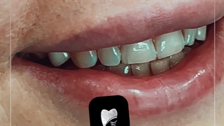 کامپوزیت دندان در کلینیک دکتر مهاجرفر