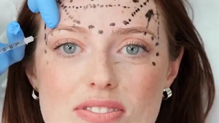 فیلم بوتاکس چشم گربه ای در اصفهان