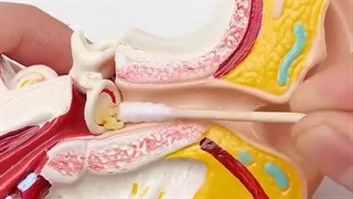 مجموعه 6 عددی ابزار تمیز کننده گوش