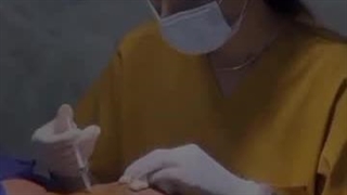کاشت مو نازنین عسکری در شیراز