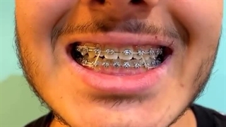 رضایت از ارتودنسی