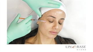 تزریق Linerase hydro