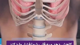 ترفند رفع قوز کمر در خانه