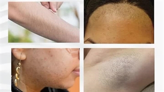 مرکز تخصصی پوست ، مو و زیبایی لیزر پارسیان بندرعباس