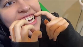 آموزش استفاده از پلاک متحرک