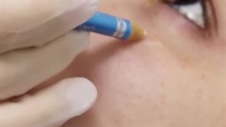 چشمانی شاداب در سولا کلینیک!