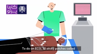 نوار قلب در منزل - انجام تست ECG در خانه با گاما پرتو