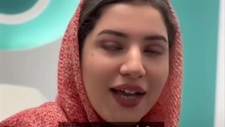 بلفاروپلاستی در کلینیک گونه