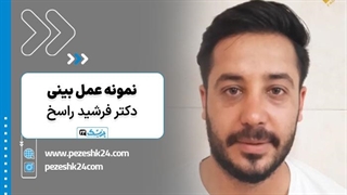 نمونه عمل بینی دکتر فرشید راسخ در اصفهان - پزشک 24