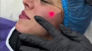 جوانسازی راحت و سریع میخوایی؟