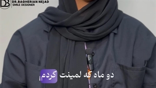 رضایت بیمار از لمینت دندان در اصفهان | دکتر دانیال باقریان نژاد