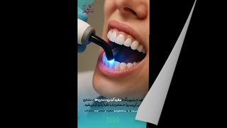 بعد از بلیچینگ چه غذا هایی نخوریم؟