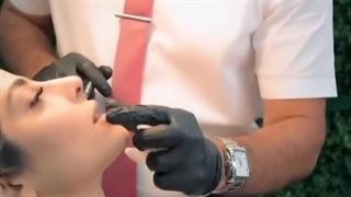 اشتباه رایج در تزریق فیلر لب