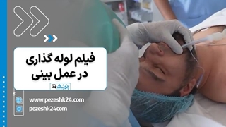 فیلم لوله گذاری در عمل بینی - پزشک 24