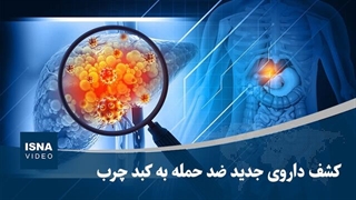 کشف داروی جدید ضد حمله به کبد چرب