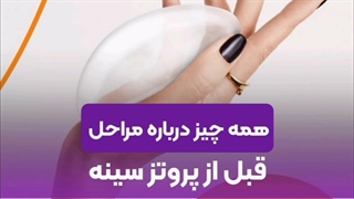 اقدامات قبل از جراحی پروتز | نکات مهم برای آماده سازی قبل از عمل