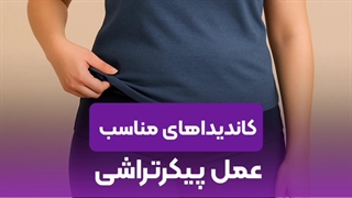 کاندید مناسب عمل پیکرتراشی