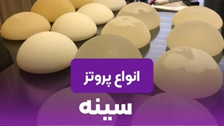 انواع پروتز