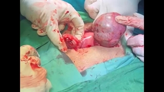 بهترین جراح و متخصص زنان و زایمان در خرم آباد