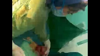 فیبروم رحم چیست ؟