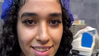 جراحی بینی خوش فرم و زیبا