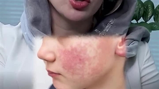 کلینیک فوق تخصصی دکتر نیلفروش‌زاده - سایت بهترین در تهران