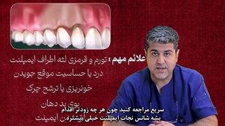 عفونت ایمپلنت دندان | چرا اتفاق می‌افتد و چگونه جلوی آن را بگیریم؟