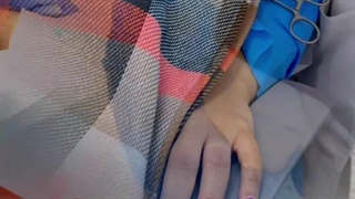 جراحی شش واحد ایمپلنت بصورت همزمان