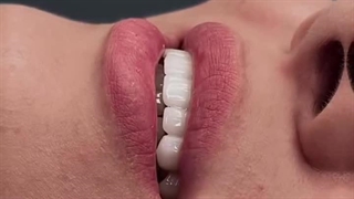 جذابیت نمونه کار ایمپلنت مرکز ایمپلنت تهران