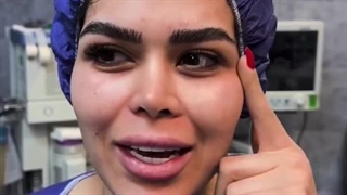 عمل لیفت پیشانی و ابرو در تهران