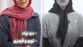 میکروبلیدینگ مریم حمزه‌ای - سایت بهترین در تهران