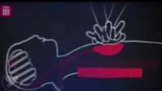 در زمان ایست قلبی چکار کنیم؟