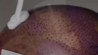 شستشو مرحله اول 12 روز