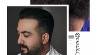 کاشت مو مریم و حدیث مسیحی